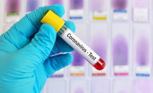 COVID-19 cases surge in Nigeria again