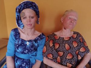 Two members of Ogun Albino Foundation in need of funds to treat skin cancer