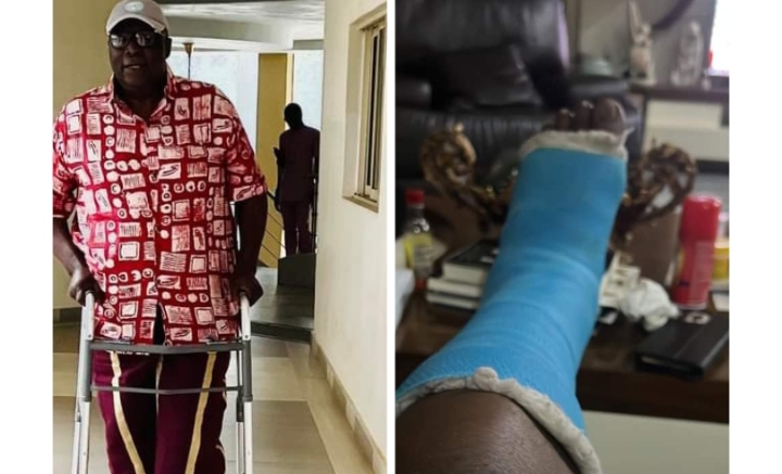 Domestic Slips, Falls, Paralysis and Death: 7 Preventive Measures – Ojudu